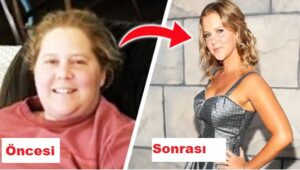Amy Schumer
